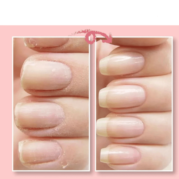 Prettynail™ - Gel Til Reparation Af Negle | 1+1 GRATIS